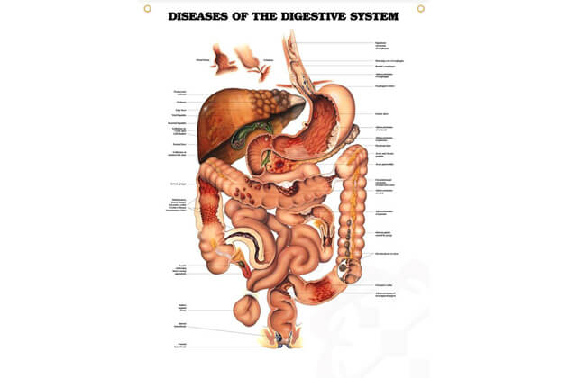 Az emésztőrendszer betegségei 50,8x66cm
